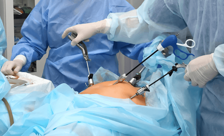 Cirugía laparoscópica